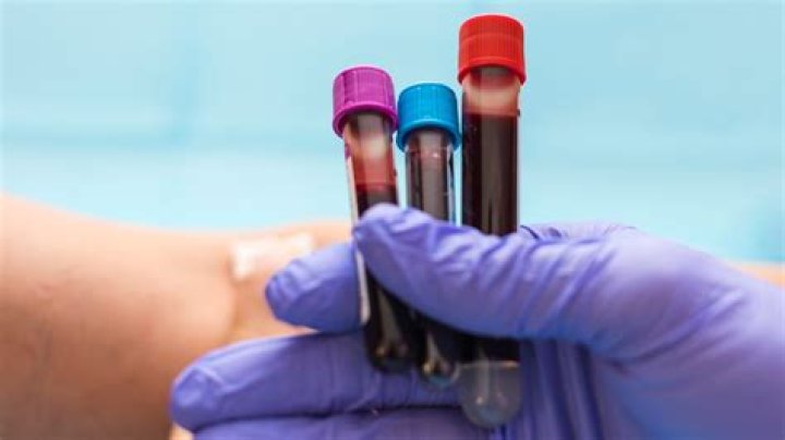 A Vial Of Blood: Unlock The Secrets Of Your Health