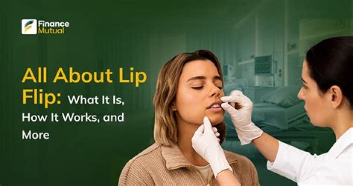 Discover Lip Flip Cleveland: Enhance Your Smile With Precision And Grace
