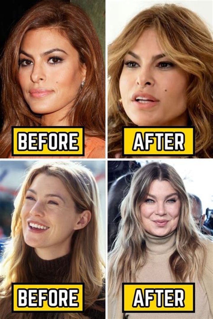 Exploring Kimberly Guilfoyle Pre Plastic Surgery: A Journey Through Transformation