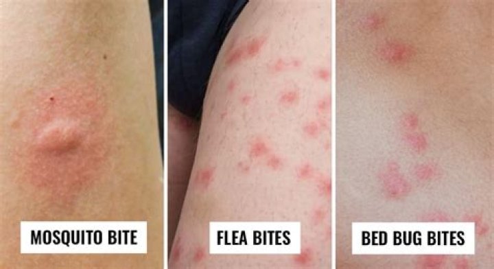 Fight Bug Bites With LaShawn Johnson's Bed Bug Expertise