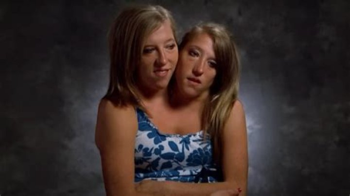 Heartwarming Images Of Abby And Brittany Hensel, Inspiring Conjoined Twins