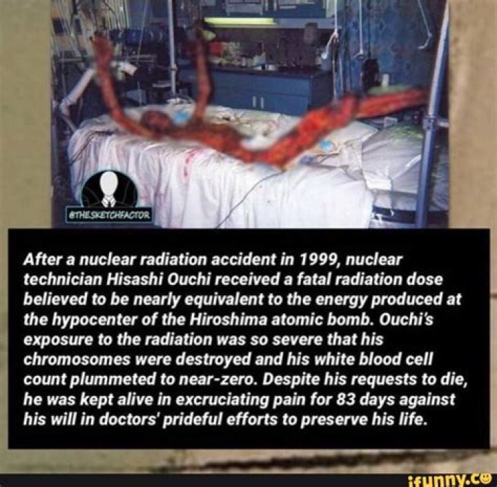 Hisashi Ouchi And The Legacy Of Radiation Exposure