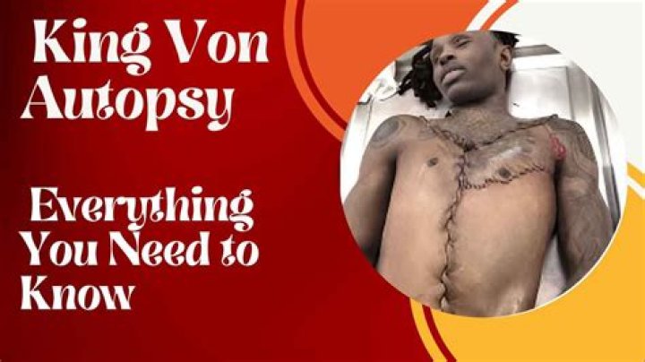 King Von Autopsy PDF Reveals Startling Discoveries