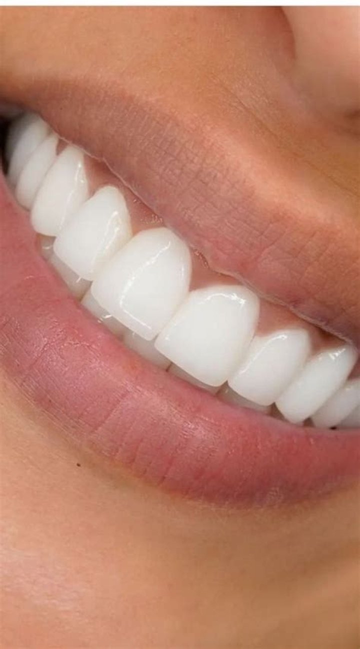 Matt Rife's Pearly Whites: A Journey Of Dental Perfection
