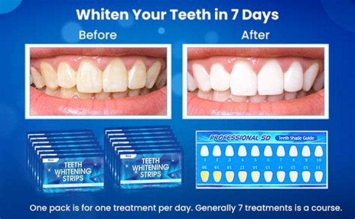 Quick Strips Dental: The Convenient And Effective Solution For Teeth Whitening