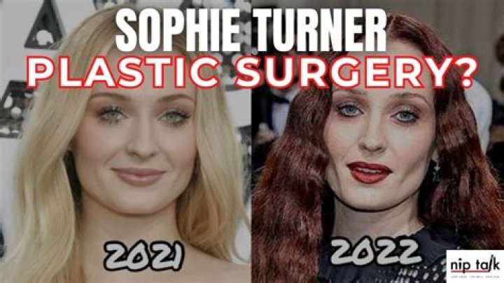 Sophie Turner Before Cosmetic Enhancements