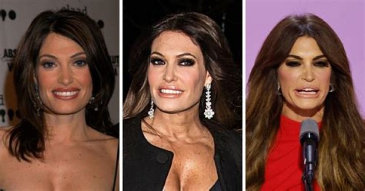 The Truth About Kimberly Guilfoyle's Plastic Surgery Journey