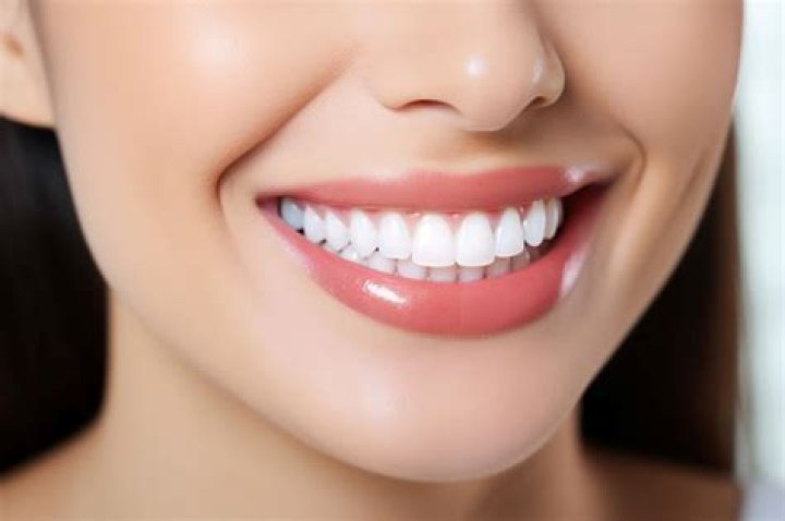 Unlocking The Secrets To A Perfect Smile