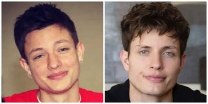 Unveiling Matt Rife's Transformation: Discoveries Before Plastic Surgery