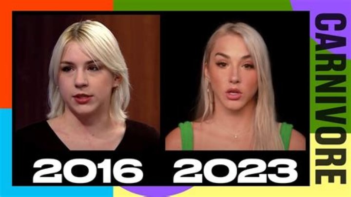 Unveiling Mikhaila Peterson's Transformative Plastic Surgery Journey