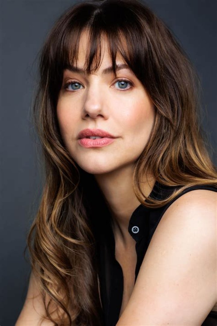 Unveiling The Inspiring Story Behind Julie Gonzalo's Scar