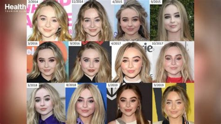 Unveiling The Truth: How Much Plastic Surgery Has Sabrina Carpenter Had?